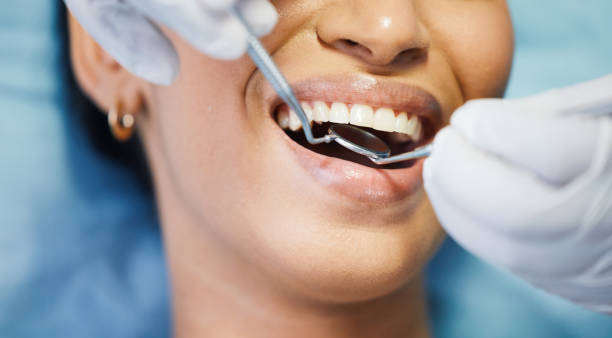 Best Emergency Tooth Extraction in Secy, AR