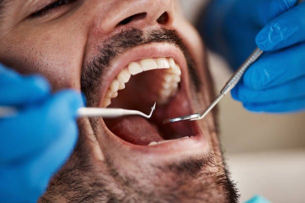 Best Walk-In Emergency Dentist in Secy, AR